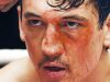 BLEED FOR THIS  Trailer 2  (2016) Miles Teller Boxing Biopic