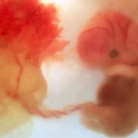 development of fetus at 5 weeks