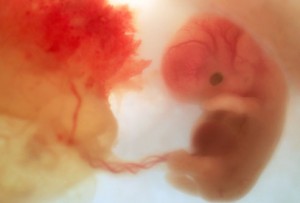 development of fetus at 5 weeks