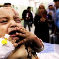Gaza Palestine Child Injured