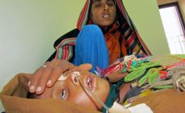 سندھ میں خسرے کی وباء، ہلاکتیں241 ہوگئیں