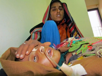 سندھ : سال2013 میں1539خسرہ کے کیسز،11بچے جاں بحق