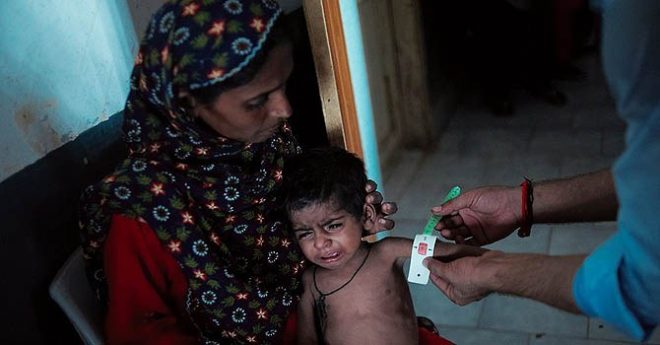 سندھ اور پنجاب میں خسرہ سے مزید 7 بچے جاں بحق