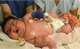 لپزنگ : دنیا کی سب سے ذیادہ وزنی بچی کی پیدائش