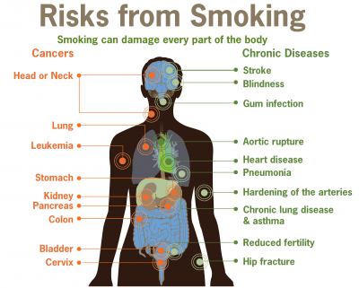 Smoking Effects