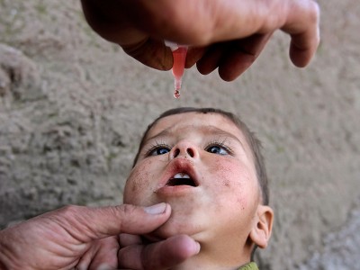 Polio Case
