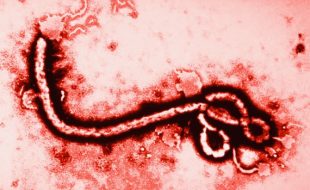 ایبولا وائرس