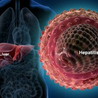 Hepatitis virus