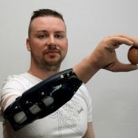 Bionic Hands