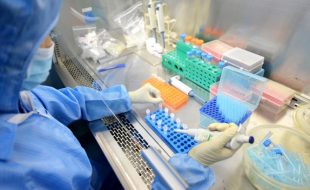 منٹوں میں مکمل ہونے والا ایبولا وائرس کا نیا ٹیسٹ منظور