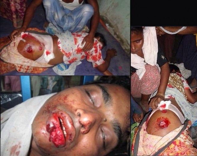 Muslim Children Were Burnt Alive In Meiktila - Burma