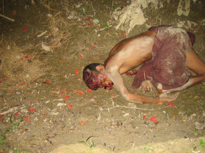 dead Rohingya body