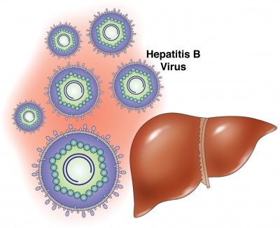 Hepatitis B Symptoms