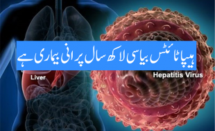 ہیپا ٹائٹس۔جگر کی بیماری