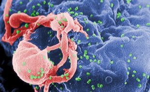 ایچ آئی وی کے خلاف ’انقلابی‘ دوا کے تجربات شروع