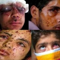 Kashmir Pellet Gun Victims
