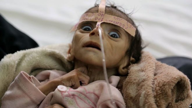 یمن میں 70 لاکھ سے زیادہ بچوں کو خوراک کی قلت کا سامنا