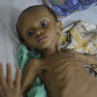 Yemen Child