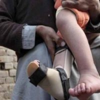 Polio Cases