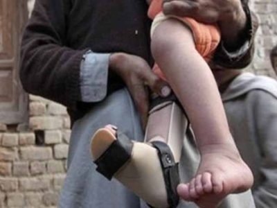 Polio Cases