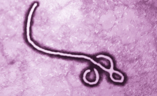 علاج کے بعد بھی ایبولا وائرس دماغ میں چھپا رہتا ہے