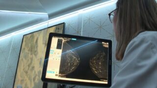 **France Considers Lowering Breast Cancer Screening Age Amid Rising Cases**&hellip;